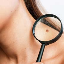 Breast Reduction